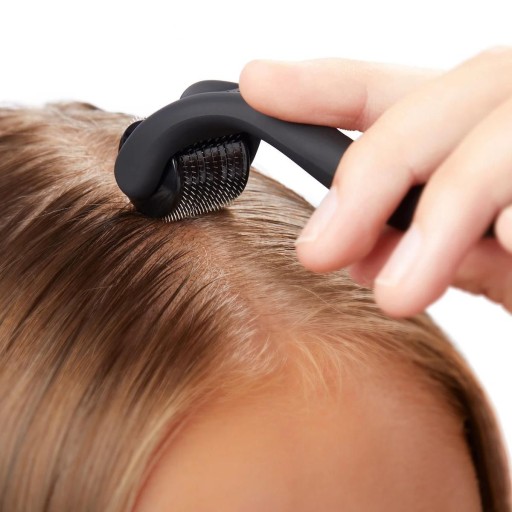 Дермароллер Derma Roller 1,0мм от облысения, лишая