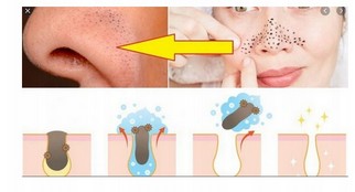 BEAUTIFLY DIAMOND МИКРОДЕРМАБРАЗИЯ B- Derma