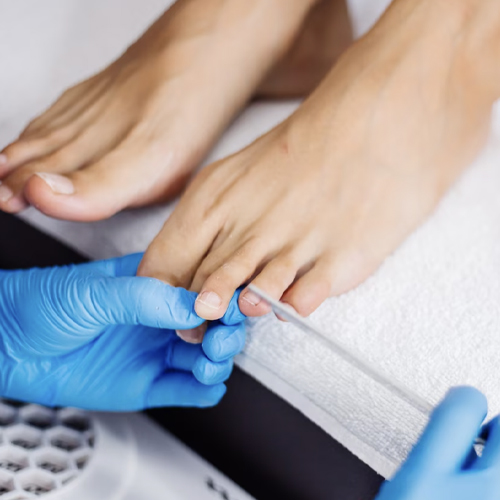 PHARM FOOT SH Препарат для онихолизиса с молозивом 15мл