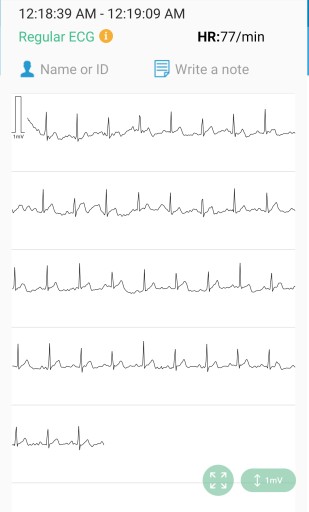 Ciśnieniomierz BP2 Aparat Monitor EKG Aplikacja na IOS Android