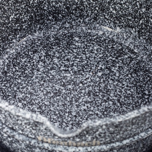 GARNKI ZESTAW GARNKÓW KOMPLET Z POKRYWKAMI RONDEL INDUKCJA GAZ OFENBACH