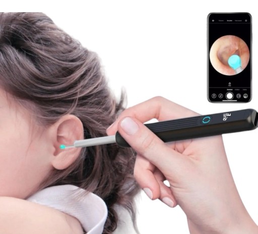SMART OTOSKOP KAMERA CZYSZCZENIE USZU WOSK WIFI HD APLIKACJA ENDOSKOP