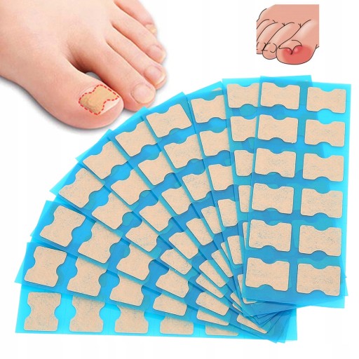 ПАТЧИ 120X STRIPES ДЛЯ ВРАСТНЫХ НОГТЕЙ