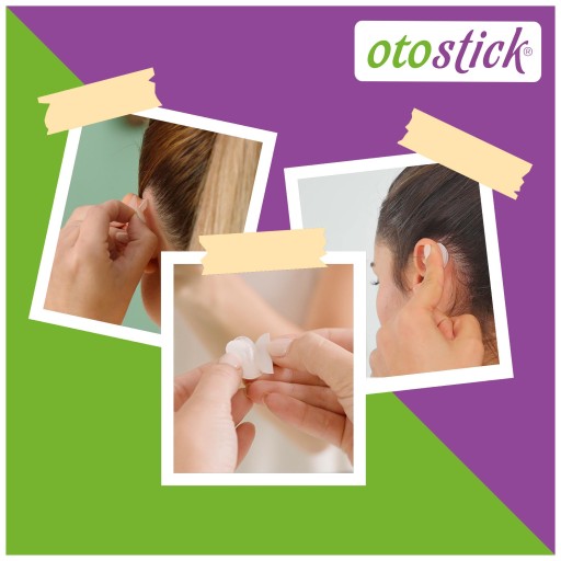 Otostick Эстетические корректоры ушей + БЕСПЛАТНЫЕ ПОДАРКИ