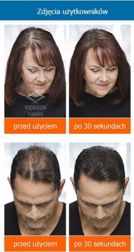 ВИКСОН 28г Для утолщения волос. Высшее качество.