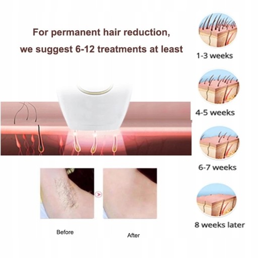 Body Bikini IPL Depilator Pulses Permanent La