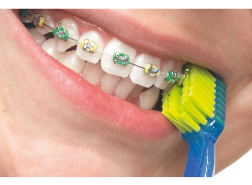 ЩЕТКА ДЛЯ ПРИБОРОВ CURAPROX CS 5460 ORTHO BLISTER
