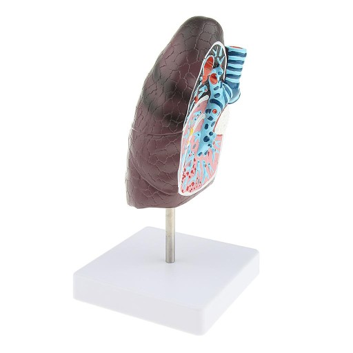 Изменения в легких органов дыхания 2:3 Lifesize M