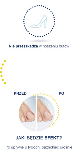 Набор Scholl от вросших ногтей.