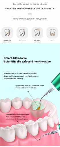 Xiaomi Ultrasonic Electric Dental Scaler Stai