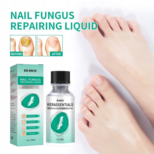 OUHOE Nail Repair Essence Nail