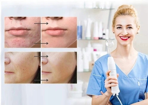 DERMA WAND ДАРСОНВАЛЬ 4 ЭЛЕКТРОДА POWERFUL PRO