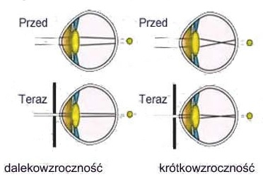 VISION HEALING Очки с дырками АЮРВЕДИЙСКАЯ коррекция глаз CE