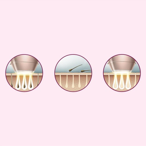 PHILIPS LUMEA IPL ЛАЗЕРНАЯ ЭПИЛЯЦИЯ BRI977 НАБОР X4 ВНИМАНИЕ ЧЕХОЛ В ПОДАРОК