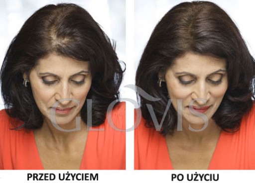 GLOVIS Concealer - Маскирующий обезжириватель для утолщения волос 10 сек