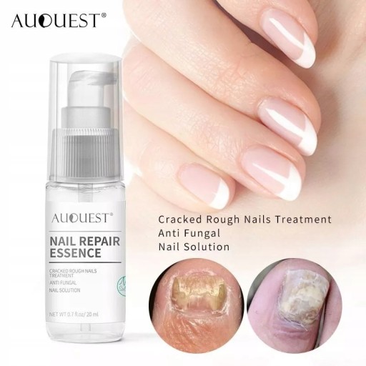 Эссенция для восстановления ногтей Nail Repair 20 мл