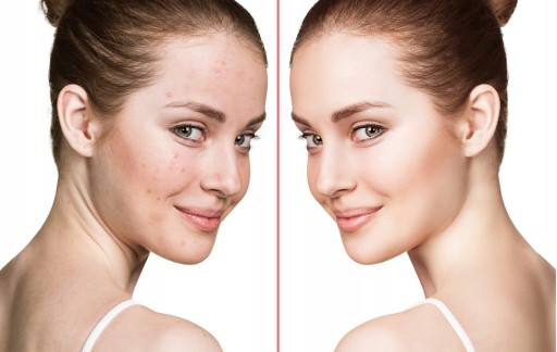 DERMA WAND ДАРСОНВАЛЬ 4 ЭЛЕКТРОДА POWERFUL PRO