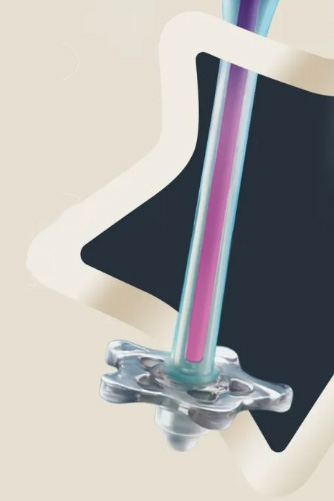 ADVANCED Tommee Tippee антиколиковая бутылочка 260 мл