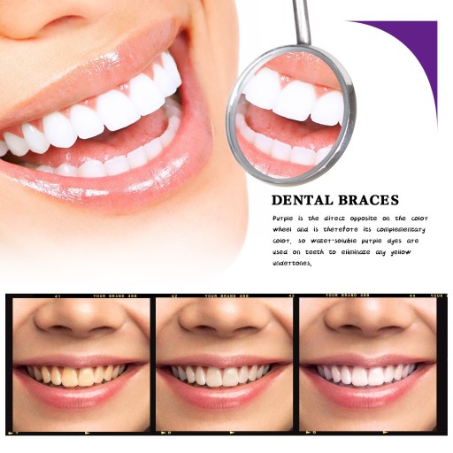 Зубная паста Hismile Whitening V34 корректор цвета 30мл