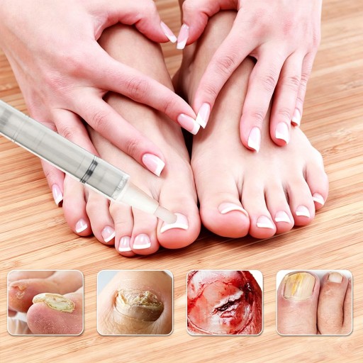 4x NAIL CARE PEN ручка-фломастер СТИК ДЛЯ УХОДА ЗА НОГТЯМИ 4 мл