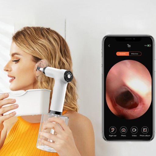 Ирригатор для чистки ушей с HD-камерой и WIFI-приложением NV300