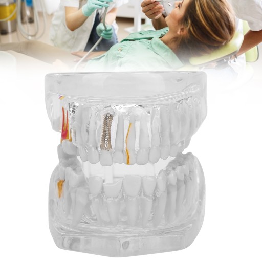MODEL ZĘBÓW DENTYSTYCZNYCH DLA DOROSŁYCH