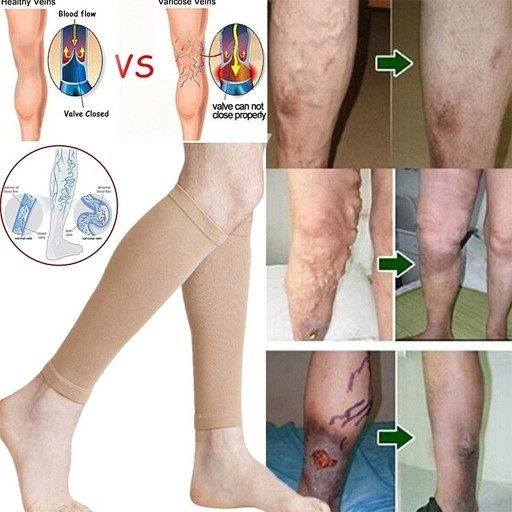 1 пара жгутов Performance Compression унисекс, кожа L