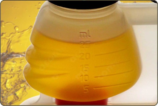 Archoil AR6900-P PB смазывает и очищает форсунки, клапана, КАТ, EGR, Турбо, GPF