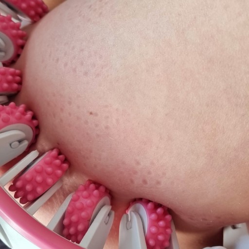 Masażer Wyszczuplający Antycellulitowy Modelujący Ujędrniający Do Ciała 3w1