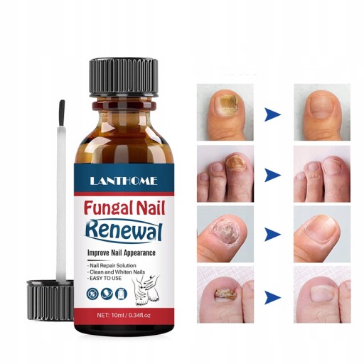 Płyn Do Naprawy Paznokci 10ml