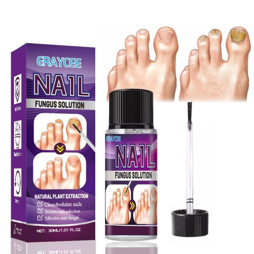 Grzybica paznokci Silny Płyn Do Naprawy Paznokci 30ml