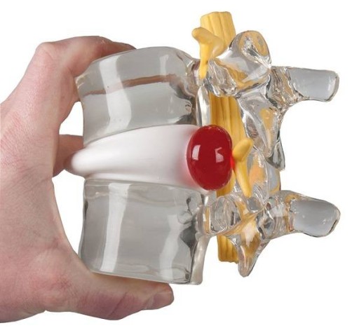 Model anatomiczny kręgosłupa SYMULATOR DYSKOPATII
