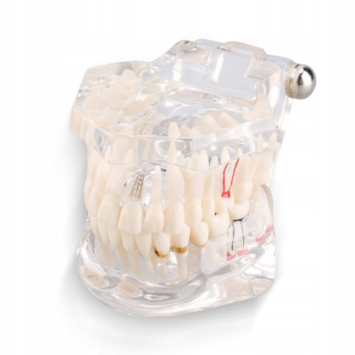 ZĘBÓW DENTYSTYCZNYCH MODEL