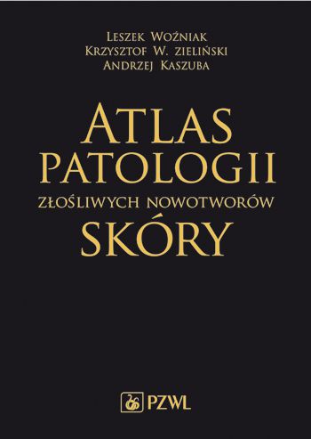 ATLAS PATOLOGII ZŁOŚLIWYCH NOWOTWORÓW SKÓRY NOWA