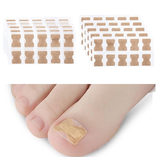 100 Pieces of Corrective Plaster for Ingrown Toenails, Toenail Correction