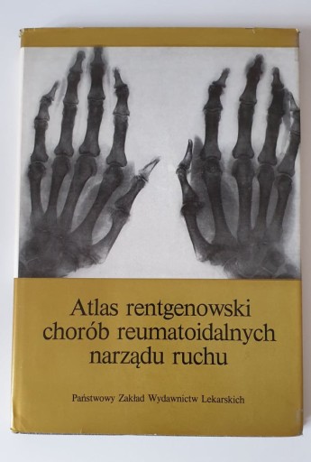 Zdjęcie oferty: Atlas rentgenowski chorób reumatoidalnych narządu 