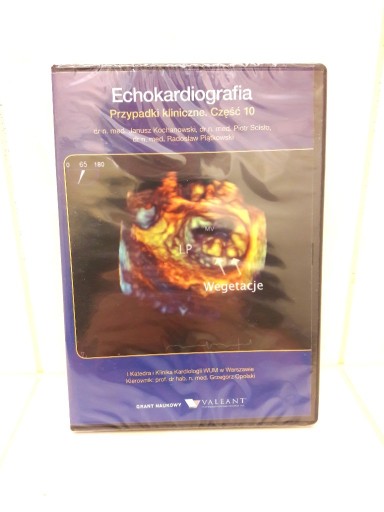 Zdjęcie oferty: DVD Echokardiografia przypadki kliniczne część 10