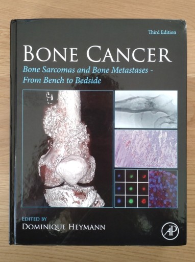 Zdjęcie oferty: Bone Cancer / trzecie wydanie 2022 rok