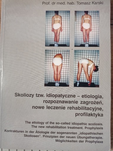 Zdjęcie oferty: Skoliozy tzw. idiopatyczne Tomasz Karski