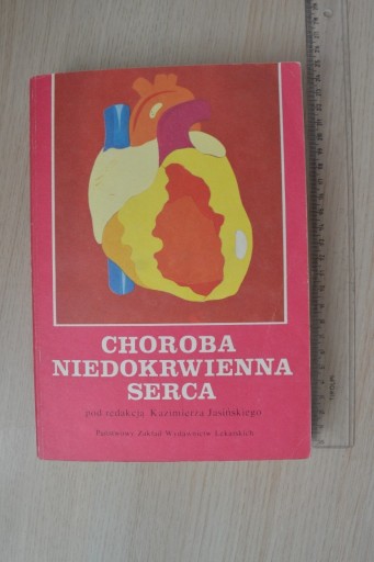 Zdjęcie oferty: Choroba niedokrwienna serca Kazimierz Jasiński