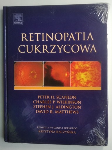 Zdjęcie oferty: Retinopatia cukrzycowa - Peter H. Scanlon