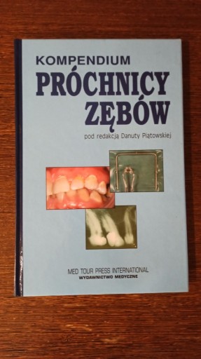 Zdjęcie oferty: D. Piątkowska - Kompendium próchnicy zębów