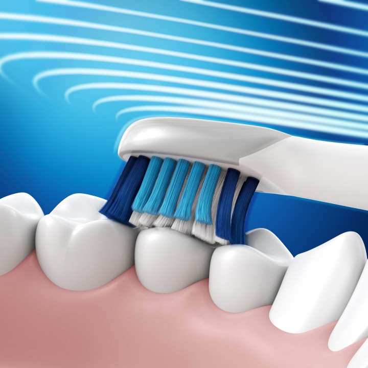 Oral-B Pulsonic Slim Clean 2000 Електрична щітка для Зубів — фото 3