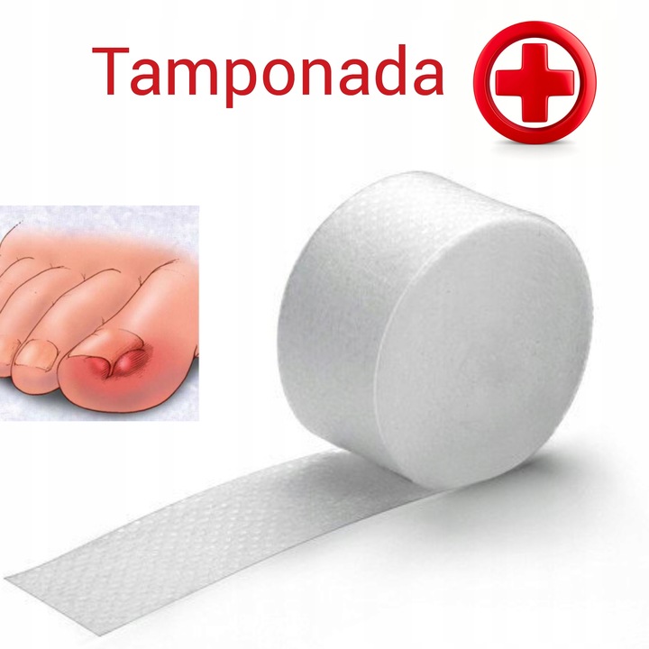 Копалайн владмива. Материал для тампонады. Материал для тампонады вросшего ногтя. Tamponadebinden steril тампонадный бинт из хлопка стерильный 5 м х 1 см. Материал для тампонады.