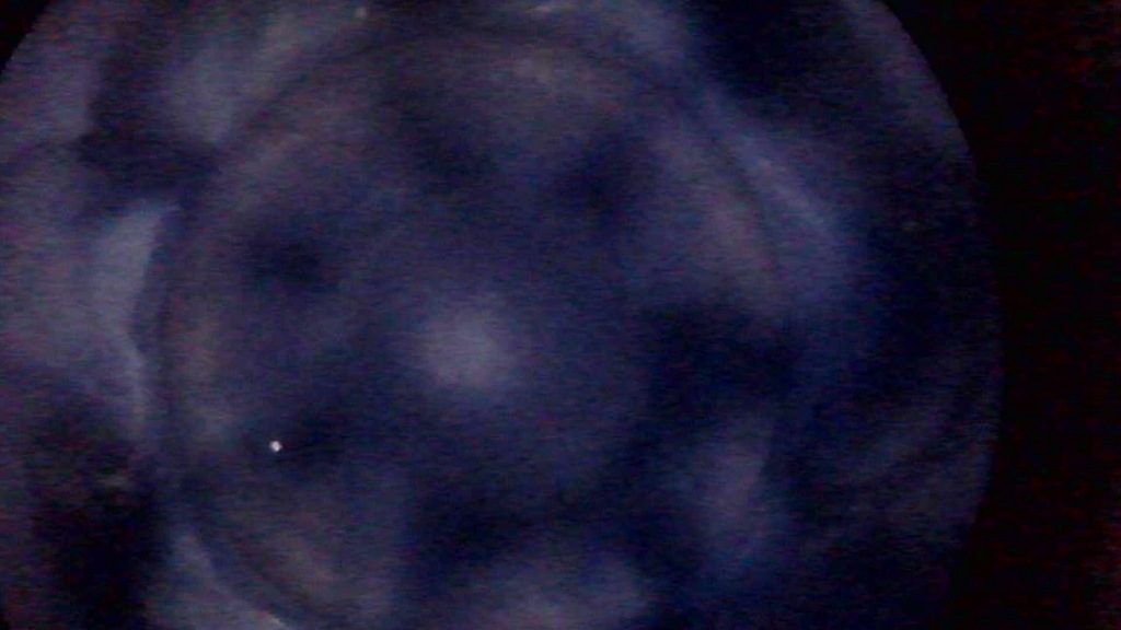 фото №13, Двигун 651950 mercedes vito w447 14- 2.2 cdi 136km film вимірювання