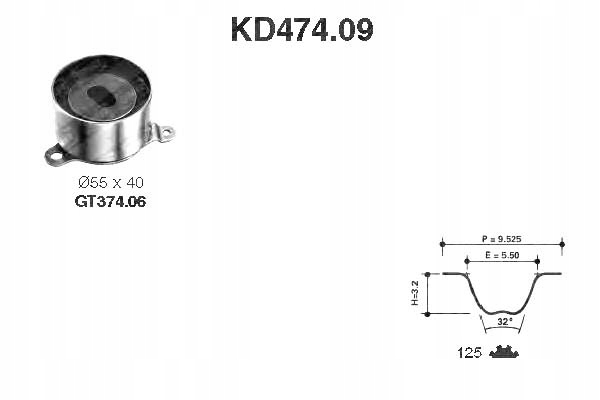 фото №2, Snr комплект - набір ремінь розподільного валу