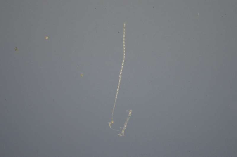 фото №4, Капот крышка двигателя голубой volvo v70 2 ii 00-07