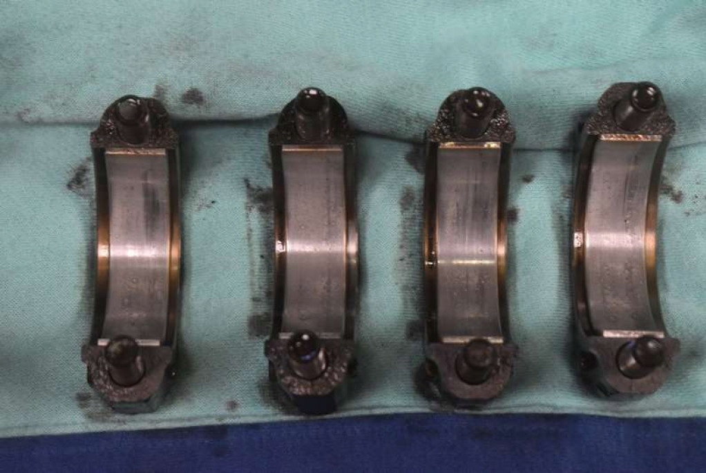 фото №8, Блок dół двигателя wał mr20 nissan qashqai 1 i j10 2.0 16v 141 km 07-10